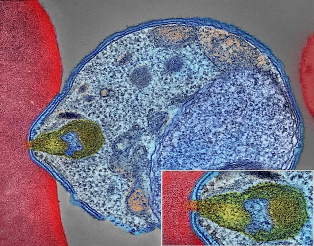 Electron micrograph image of the malaria attacking a blood cell
